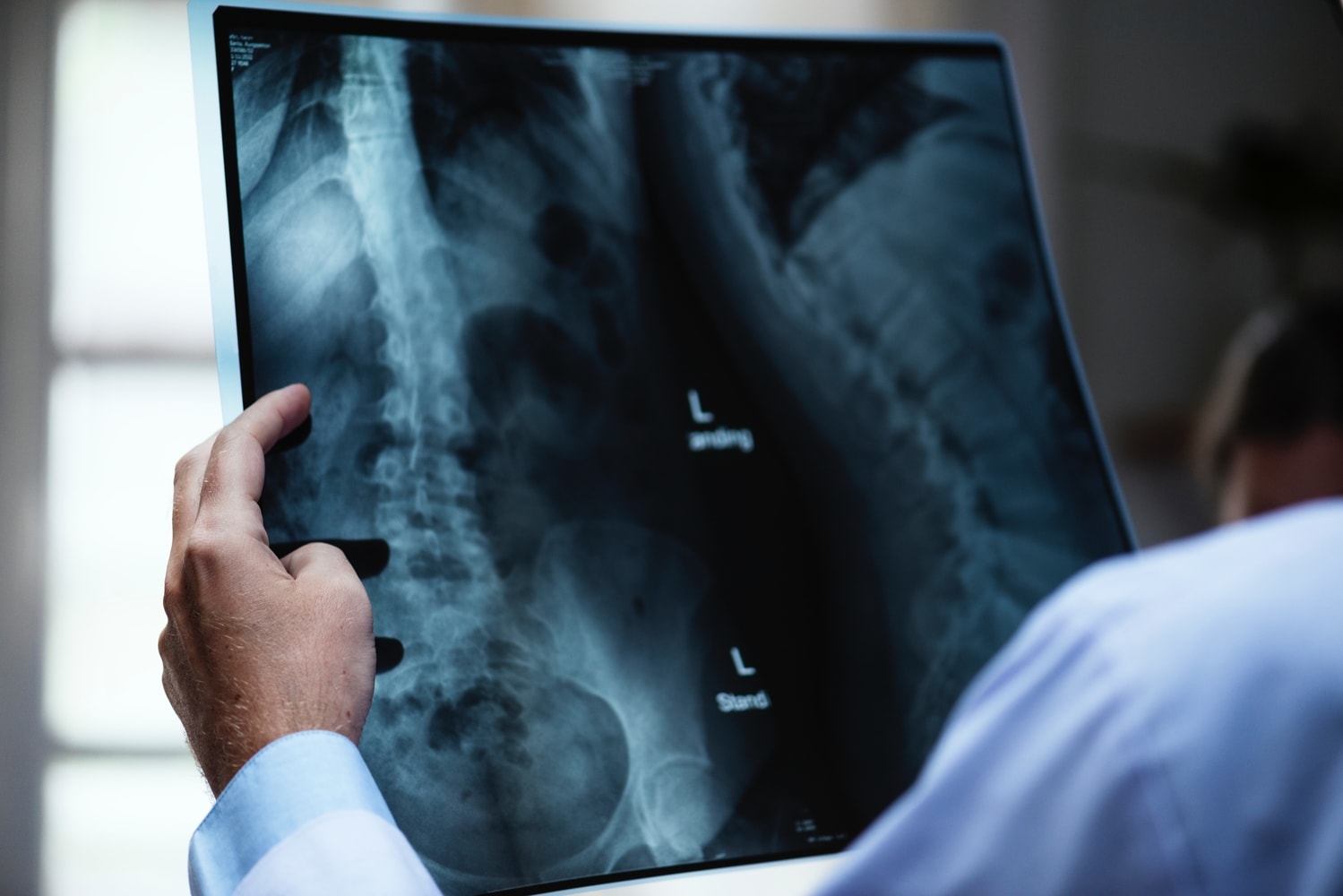 5 Tips to Keep your Spine Healthy at last